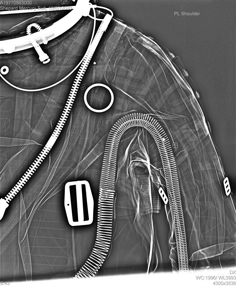 An X-ray of the interior of the space suit, showing various tubes and metal components.